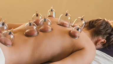Image for MFC 75 min Myofascial Cupping and Deep Tissue Massage