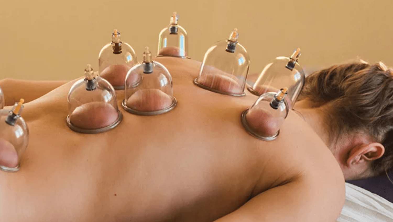 Image for New Client  60 min Myofascial Cupping Massage Treatment