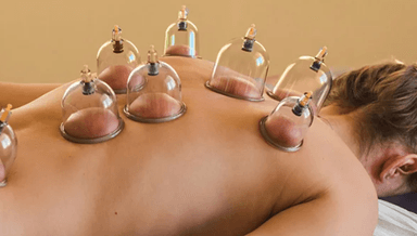 Image for MFC 30 min Myofascial Cupping and Deep Tissue Massage
